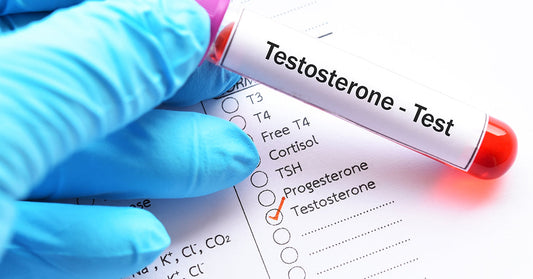 TESTOSTERONE TEST