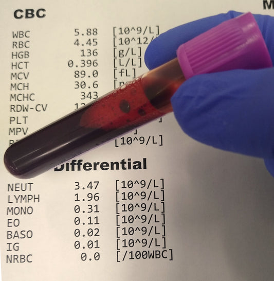WBC Differencial (Neu,Lym,Mon,Eos,Bas)