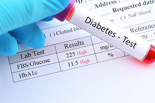 FASTING GLUCOSE TEST