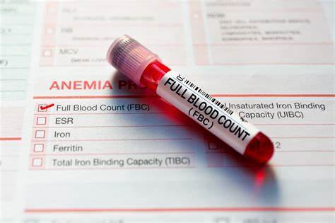 Full Blood Count Test