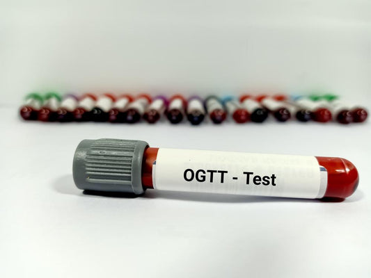 ORAL GLUCOSE TOLERANCE TEST
