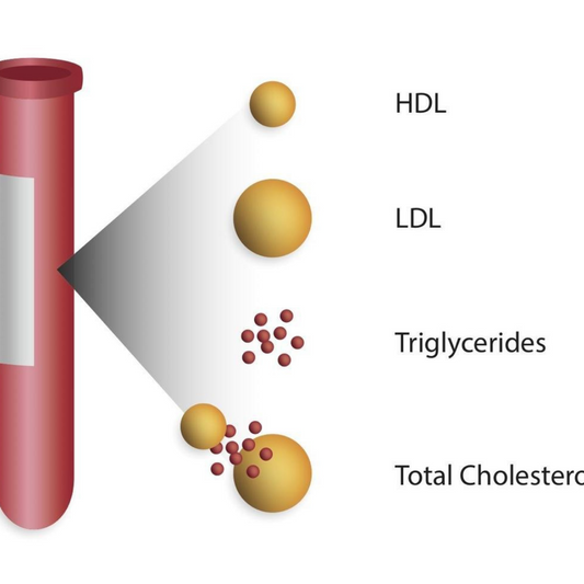 Cholesterol Tests (Lipid Panel)