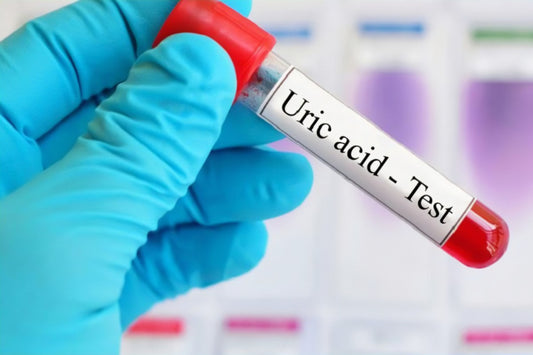 Uric Acid Test (Gout & Kidney Screening)