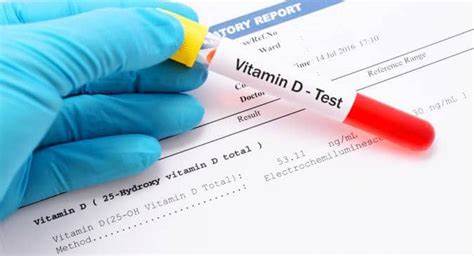 Vitamin D Test