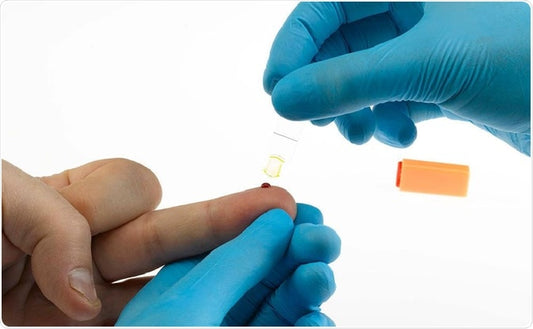 Hemoglobin Test